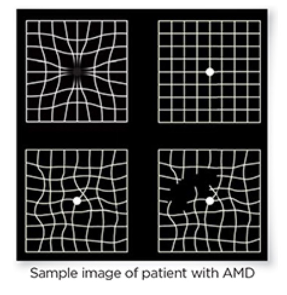 Grid Test KR-800S (picture).jpg